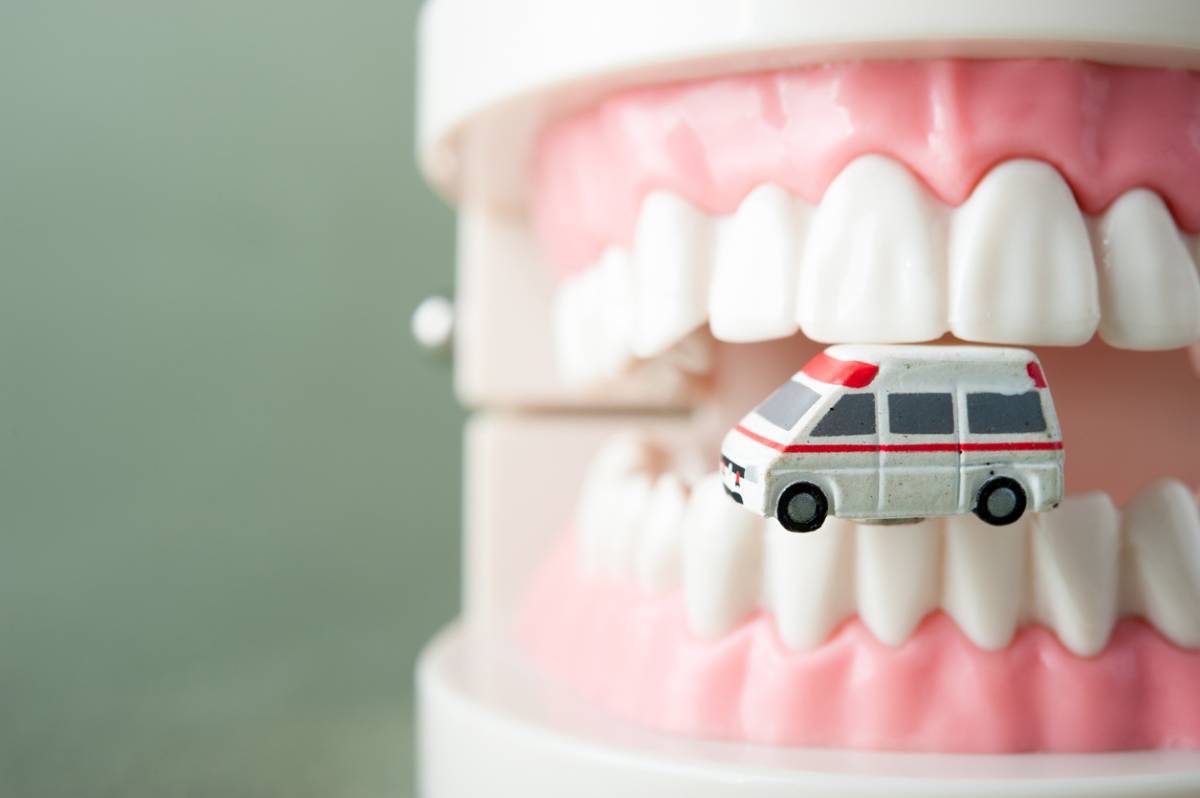 featured image for can emergency rooms remove teeth